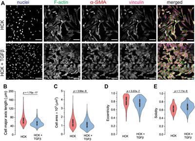 Myofibroblast transdifferentiation of keratocytes results in slower migration and lower sensitivity to mesoscale curvatures